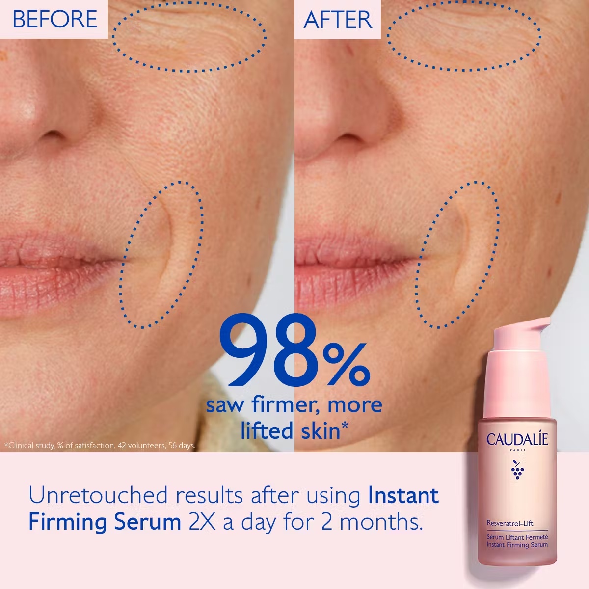 Instant Firming Retinol Alternative Serum 30 ml